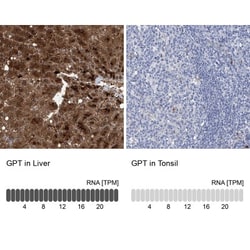 GPT Antibody, Novus Biologicals 0.1mL; Unlabeled:Antibodies, Polyclonal